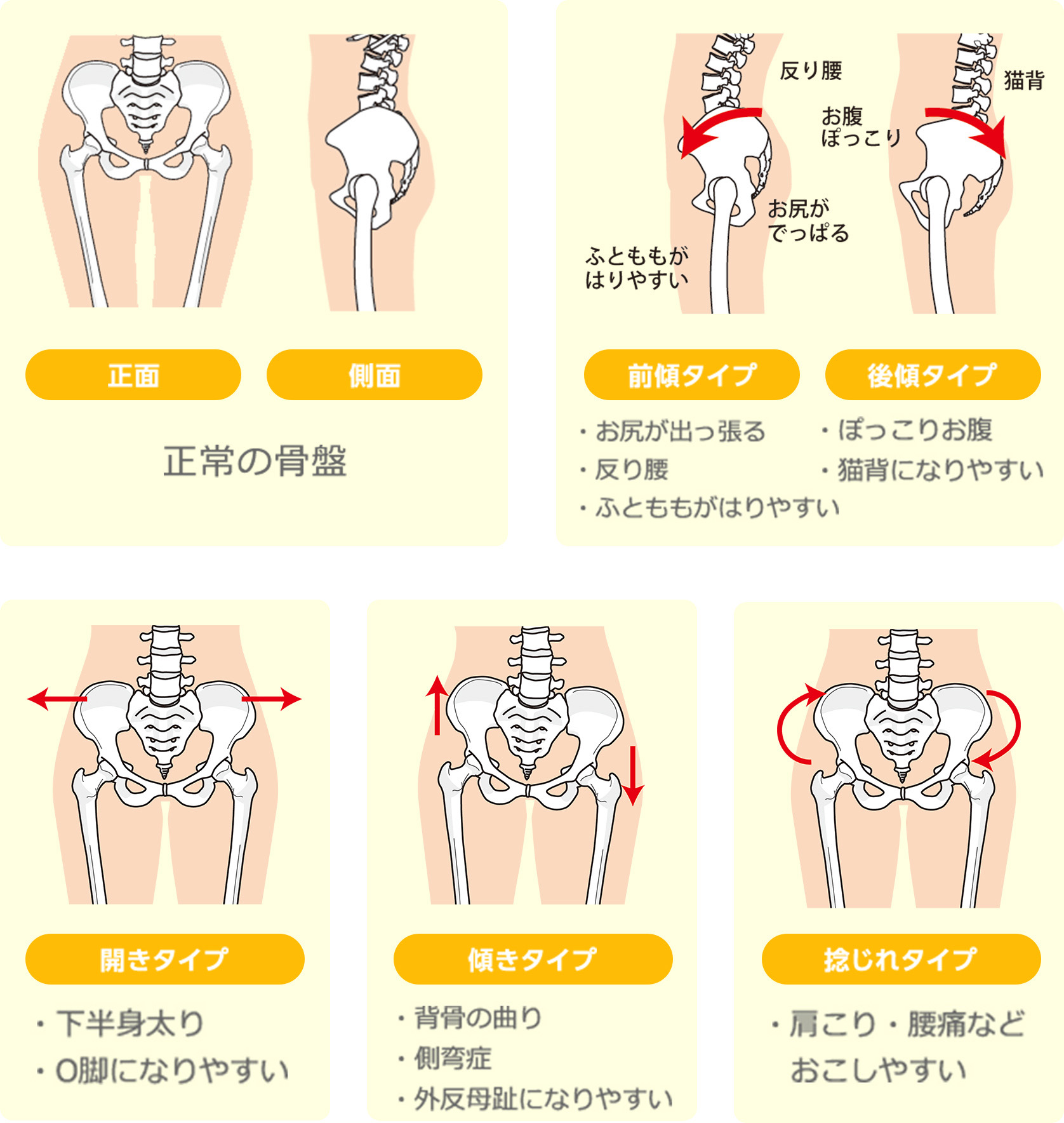 骨盤矯正の様子